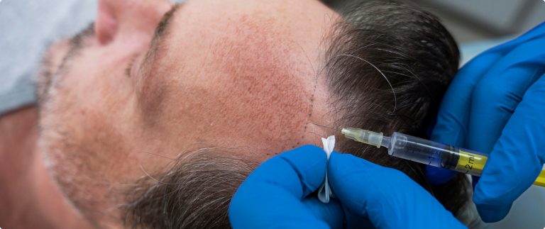 4 Things Your Hair Can Say About Your Health